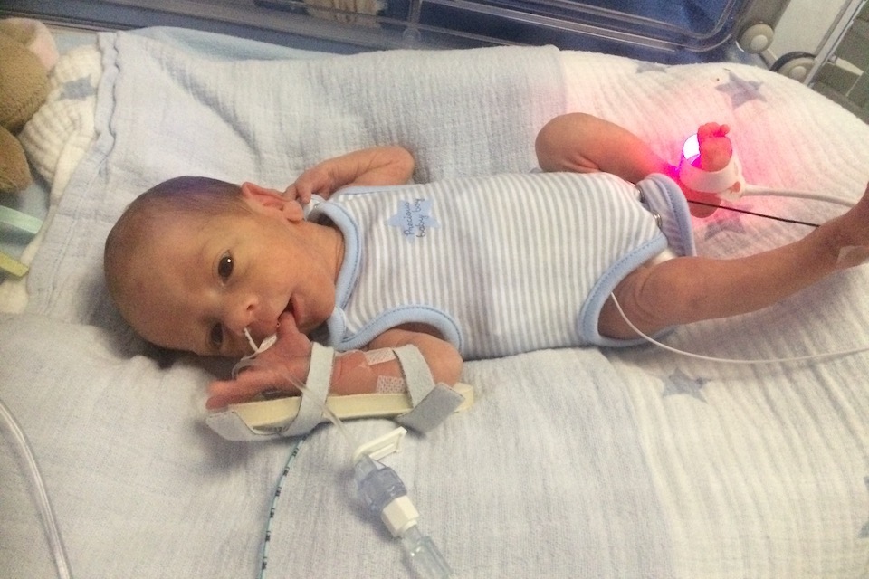 Image of premature baby Luca Giudice